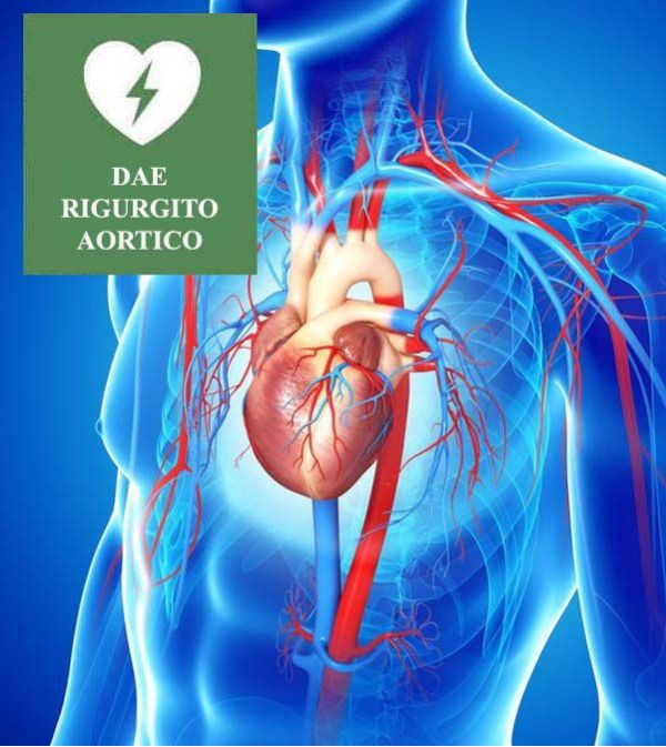 IL RIGURGITO AORTICO